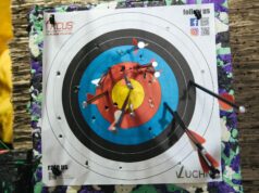 La formación reticular ascendente: ¿qué es y cómo funciona?